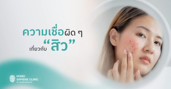ความเชื่อผิดๆ เกี่ยวกับสิว